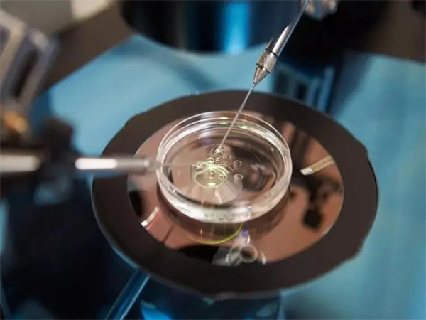 amh水平与年龄对照表：速看35岁参考值是多少